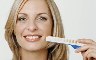 Le blanchiment des dents chez le dentiste