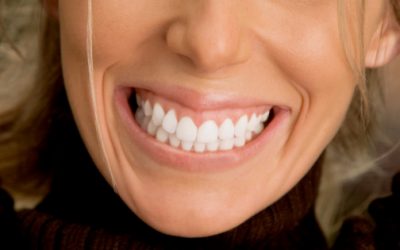 Les avantages du blanchiment des dents chez le dentiste