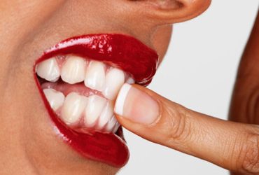 Comment prévenir les dents sensibles ?